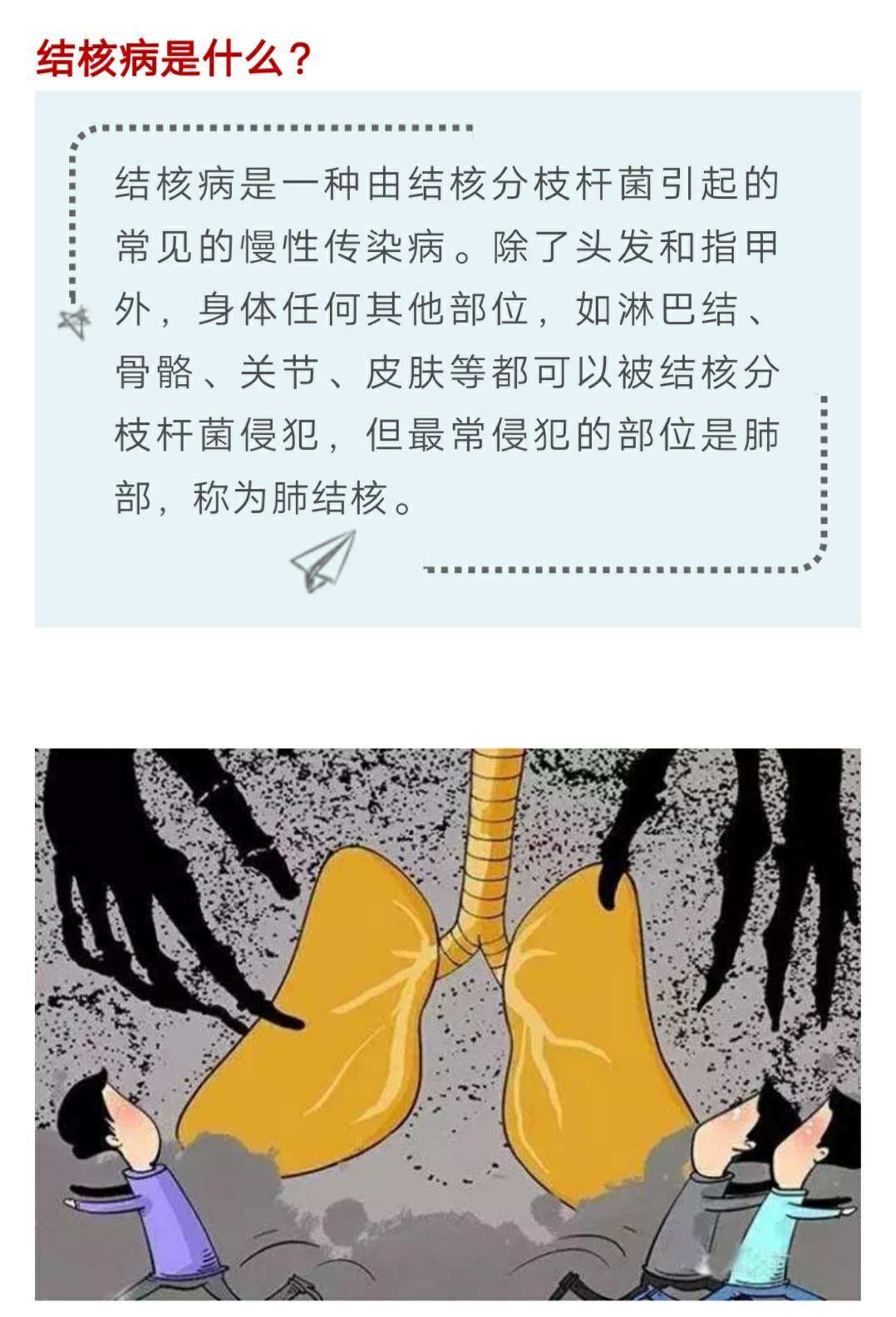 鸟[型]结核分支杆菌_严重卡氏肺孢子虫肺炎能治好吗_三型肺结核严重吗