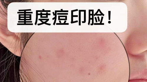 只是游乐场 